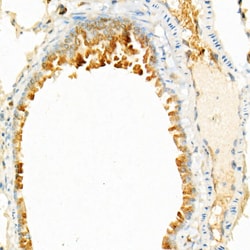 Invitrogen STING Recombinant Rabbit Monoclonal Antibody (9V9A3) 100 &mu;L;