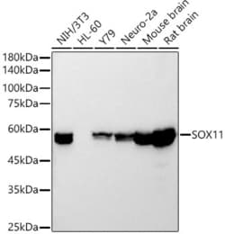 Invitrogen SOX11 Recombinant Rabbit Monoclonal Antibody (5K1J5) 100 &mu;L;