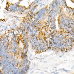 Invitrogen VDAC2 Recombinant Rabbit Monoclonal Antibody (5R5V8) 100 &mu;L;