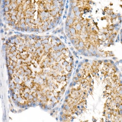 Invitrogen VDAC2 Recombinant Rabbit Monoclonal Antibody (5R5V8) 100 &mu;L;
