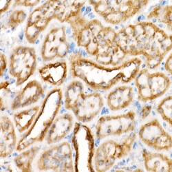 Invitrogen VDAC2 Recombinant Rabbit Monoclonal Antibody (5R5V8) 100 &mu;L;