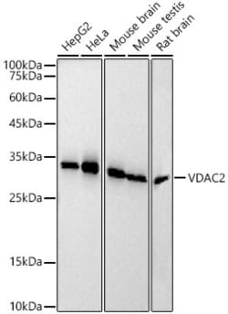 Invitrogen VDAC2 Recombinant Rabbit Monoclonal Antibody (5R5V8) 100 &mu;L;