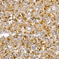 Invitrogen PYCARD Recombinant Rabbit Monoclonal Antibody (7Y8A7) 100 &mu;L;