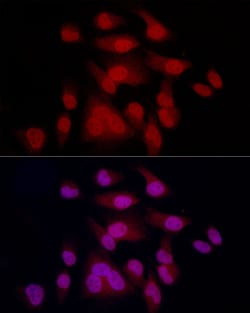 Invitrogen MiTF Recombinant Rabbit Monoclonal Antibody (6S9G4) 100 &mu;L;