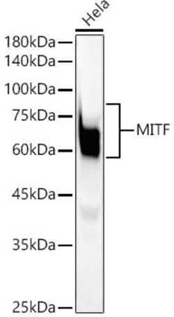 Invitrogen MiTF Recombinant Rabbit Monoclonal Antibody (6S9G4) 100 &mu;L;