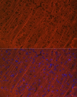 Invitrogen MAP2 Recombinant Rabbit Monoclonal Antibody (2W0O8) 100 &mu;L;