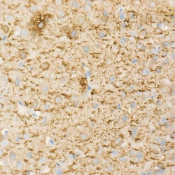 Invitrogen MAP2 Recombinant Rabbit Monoclonal Antibody (2W0O8) 100 &mu;L;