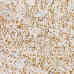 Invitrogen MAP2 Recombinant Rabbit Monoclonal Antibody (2W0O8) 100 &mu;L;