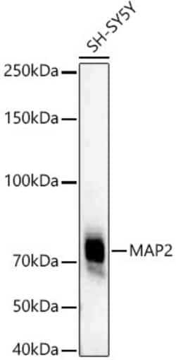 Invitrogen MAP2 Recombinant Rabbit Monoclonal Antibody (2W0O8) 100 &mu;L;