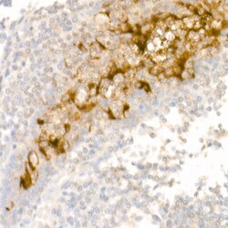 Invitrogen Mesothelin Recombinant Rabbit Monoclonal Antibody (1I1Y7) 100