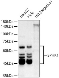 Invitrogen SPHK1 Recombinant Rabbit Monoclonal Antibody (2L6P4) 100 &mu;L;