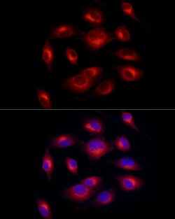 Invitrogen Melan-A Recombinant Rabbit Monoclonal Antibody (8U1D0) 100 &mu;L;