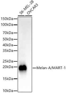 Invitrogen Melan-A Recombinant Rabbit Monoclonal Antibody (8U1D0) 100 &mu;L;