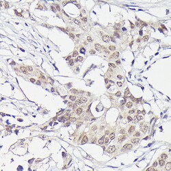 Invitrogen PFKFB3 Recombinant Rabbit Monoclonal Antibody (8P0T6) 100 &mu;L;