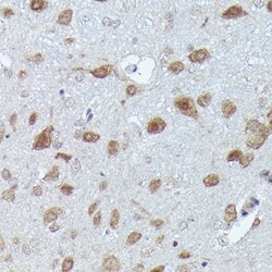 Invitrogen PFKFB3 Recombinant Rabbit Monoclonal Antibody (8P0T6) 100 &mu;L;