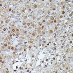 Invitrogen PFKFB3 Recombinant Rabbit Monoclonal Antibody (8P0T6) 100 &mu;L;