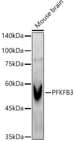 Invitrogen PFKFB3 Recombinant Rabbit Monoclonal Antibody (8P0T6) 100 &mu;L;