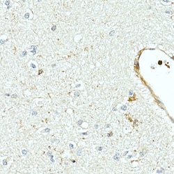 Invitrogen MMP7 Recombinant Rabbit Monoclonal Antibody (8T4R8) 100 &mu;L;