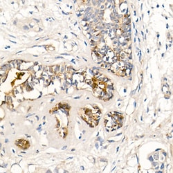 Invitrogen MMP7 Recombinant Rabbit Monoclonal Antibody (8T4R8) 100 &mu;L;