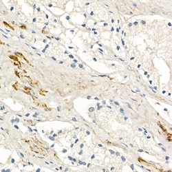 Invitrogen™ MMP7 Recombinant Rabbit Monoclonal Antibody (8T4R8)
