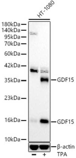 Invitrogen GDF15 Recombinant Rabbit Monoclonal Antibody (10K4Y8) 100 &mu;L;