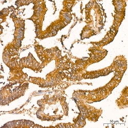 Invitrogen NFkB p65 Recombinant Rabbit Monoclonal Antibody (6D6R8) 100 &mu;L | Buy Online | Invitrogen&trade; | Fisher Scientific