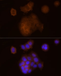 Invitrogen SOCS1 Recombinant Rabbit Monoclonal Antibody (5T6Z10) 100 &mu;L;
