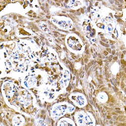 Invitrogen SOCS1 Recombinant Rabbit Monoclonal Antibody (5T6Z10) 100 &mu;L;