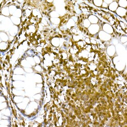 Invitrogen SOCS1 Recombinant Rabbit Monoclonal Antibody (5T6Z10) 100 &mu;L;
