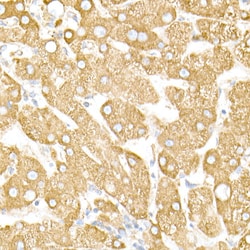 Invitrogen Calreticulin Recombinant Rabbit Monoclonal Antibody (10J1K8)