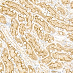 Invitrogen Calreticulin Recombinant Rabbit Monoclonal Antibody (10J1K8)