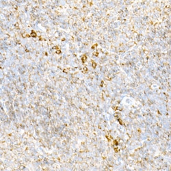 Invitrogen Calreticulin Recombinant Rabbit Monoclonal Antibody (10J1K8)