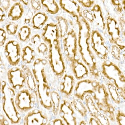Invitrogen Calreticulin Recombinant Rabbit Monoclonal Antibody (10J1K8)
