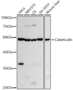 Invitrogen Calreticulin Recombinant Rabbit Monoclonal Antibody (10J1K8)