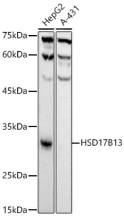 Invitrogen HSD17B13 Recombinant Rabbit Monoclonal Antibody (10T10L5) 100