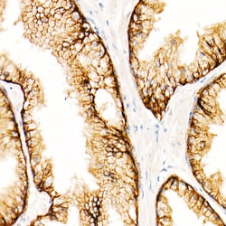 Invitrogen MRP4 Recombinant Rabbit Monoclonal Antibody (3K4F4) 100 &mu;L;