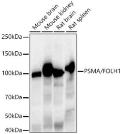 Invitrogen PSMA Recombinant Rabbit Monoclonal Antibody (7M9F5) 100 &mu;L;