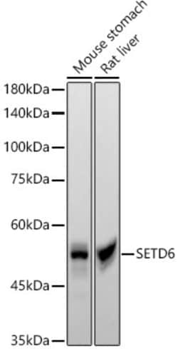 Invitrogen SETD6 Recombinant Rabbit Monoclonal Antibody (1Q1Z3) 100 &mu;L | Buy Online | Invitrogen&trade; | Fisher Scientific