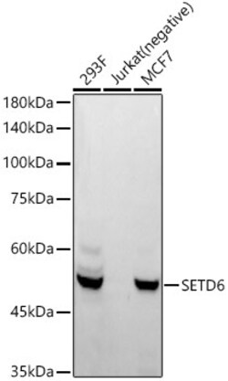 Invitrogen SETD6 Recombinant Rabbit Monoclonal Antibody (1Q1Z3) 100 &mu;L | Buy Online | Invitrogen&trade; | Fisher Scientific
