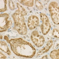 Invitrogen ATP Citrate Lyase Recombinant Rabbit Monoclonal Antibody (2N2W3)