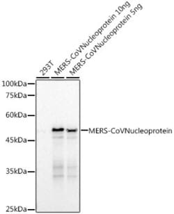 Invitrogen MERS Coronavirus NP Recombinant Rabbit Monoclonal Antibody (1R8L7) 100 &mu;L | Buy Online | Invitrogen&trade; | Fisher Scientific