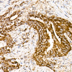 Invitrogen NDUFS1 Recombinant Rabbit Monoclonal Antibody (8M0X4) 100 &mu;L | Buy Online | Invitrogen&trade; | Fisher Scientific