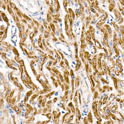 Invitrogen NDUFS1 Recombinant Rabbit Monoclonal Antibody (8M0X4) 100 &mu;L | Buy Online | Invitrogen&trade; | Fisher Scientific
