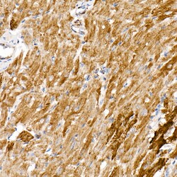Invitrogen NDUFS1 Recombinant Rabbit Monoclonal Antibody (8M0X4) 100 &mu;L | Buy Online | Invitrogen&trade; | Fisher Scientific