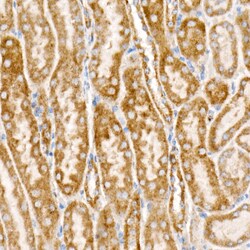 Invitrogen NDUFS1 Recombinant Rabbit Monoclonal Antibody (8M0X4) 100 &mu;L | Buy Online | Invitrogen&trade; | Fisher Scientific