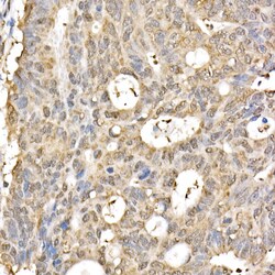 Invitrogen CHOP Recombinant Rabbit Monoclonal Antibody (7L3A1) 100 &mu;L;