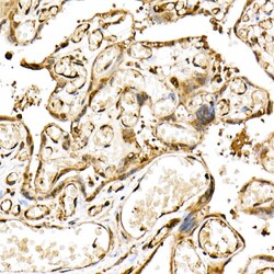Invitrogen CHOP Recombinant Rabbit Monoclonal Antibody (7L3A1) 100 &mu;L;