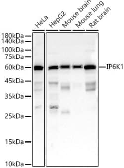 Invitrogen IP6K1 Recombinant Rabbit Monoclonal Antibody (9P5R5) 100 &mu;L;
