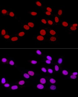 Invitrogen RbAp46 Recombinant Rabbit Monoclonal Antibody (3L1H6) 100 &mu;L;