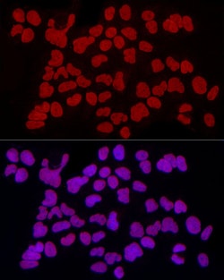 Invitrogen RbAp46 Recombinant Rabbit Monoclonal Antibody (3L1H6) 100 &mu;L;